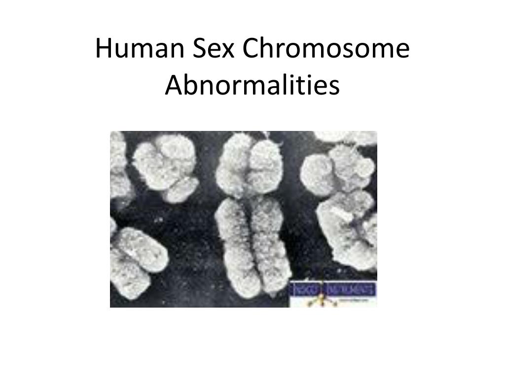 PPT - Human Sex Chromosome Abnormalities PowerPoint Presentation, free ...