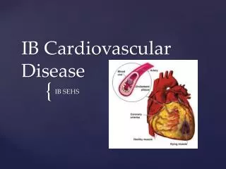 IB Cardiovascular Disease