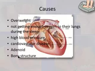 causes