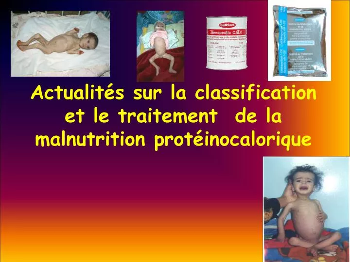 actualit s sur la classification et le traitement de la malnutrition prot inocalorique