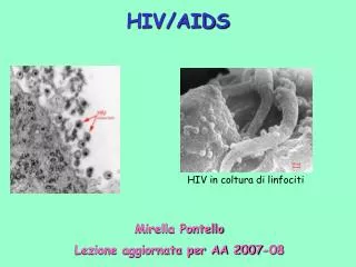 HIV/AIDS