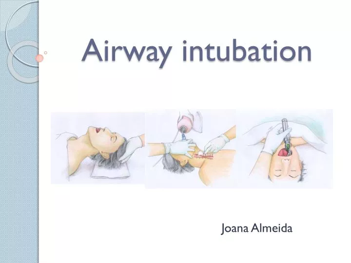 airway intubation