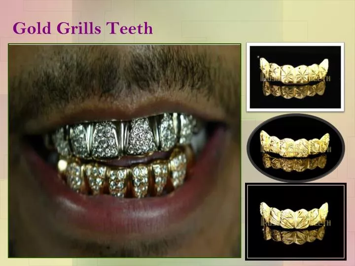 gold grills teeth