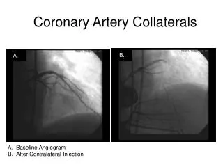 Coronary Artery Collaterals