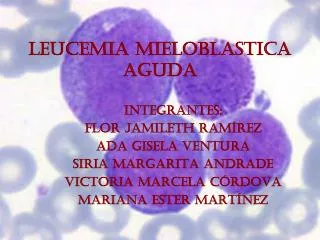 leucemia mieloblastica aguda