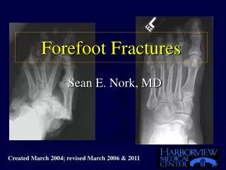 Forefoot Fractures