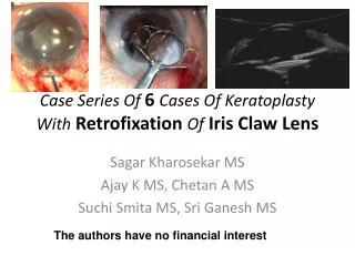 Case Series Of 6 Cases Of Keratoplasty With Retrofixation Of Iris Claw Lens