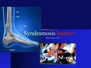 Syndesmosis Injuries
