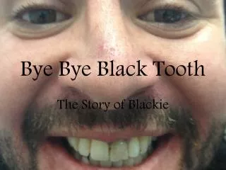 Bye Bye Black Tooth