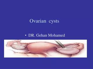 Ovarian cysts