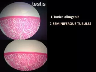 2-SEMINIFEROUS TUBULES