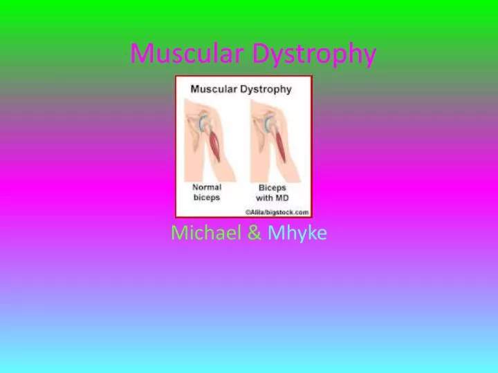 muscular dystrophy