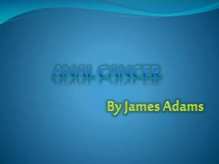 anal cancer