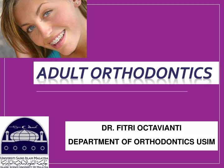 PPT ADULT ORTHODONTICS PowerPoint Presentation, free download ID