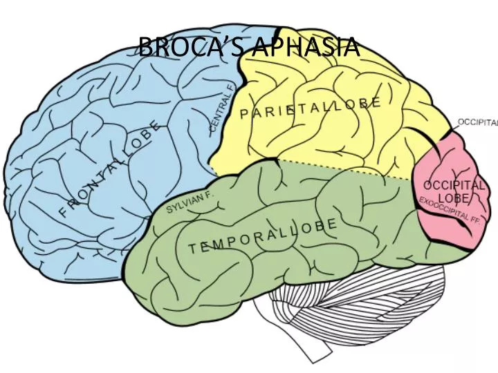 Wernicke's & Broca's aphasia Brain & Language LING 411/412/489