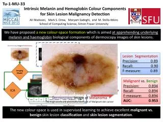Intrinsic Melanin and Hemoglobin Colour Components for Skin Lesion Malignancy Detection