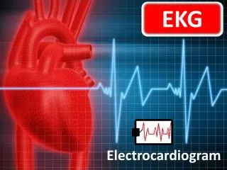 EKG