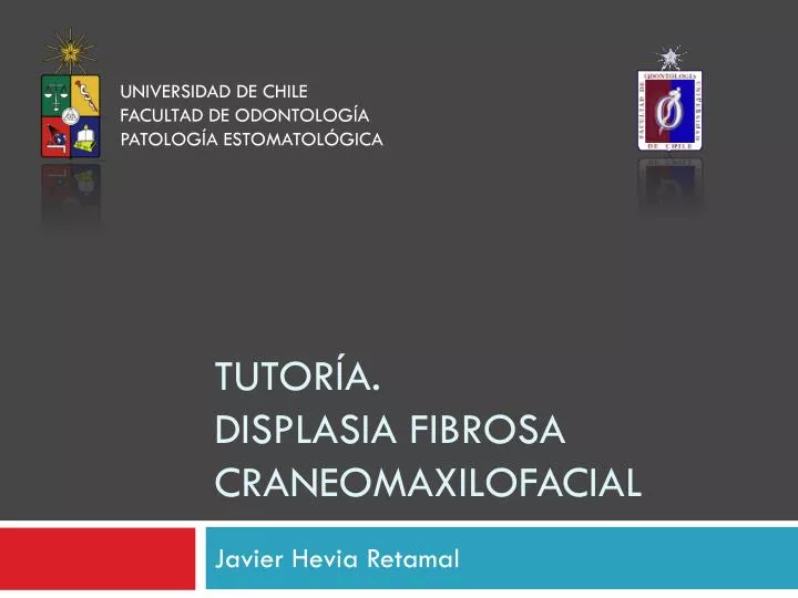 tutor a displasia fibrosa craneomaxilofacial