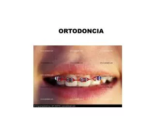ortodoncia