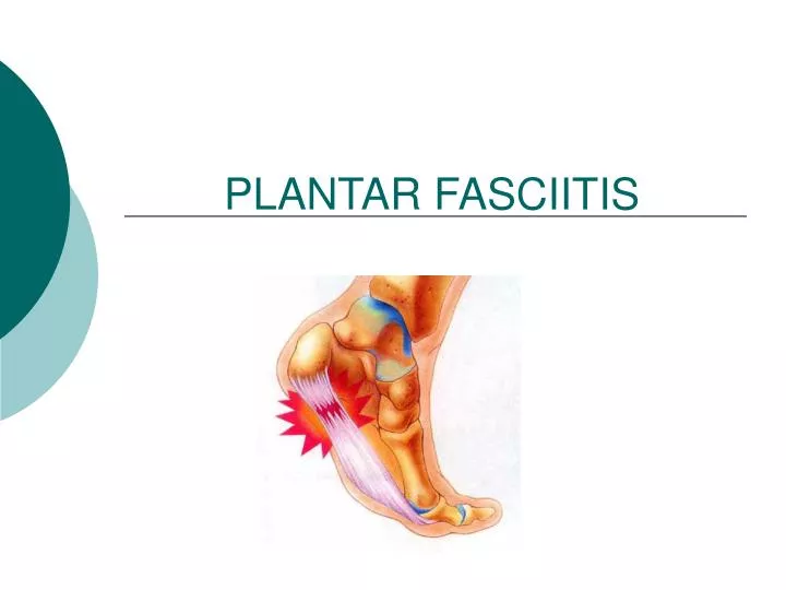 Plantar Fasciitis Physiotherapy Treatment