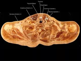 Serratus Anterior m.