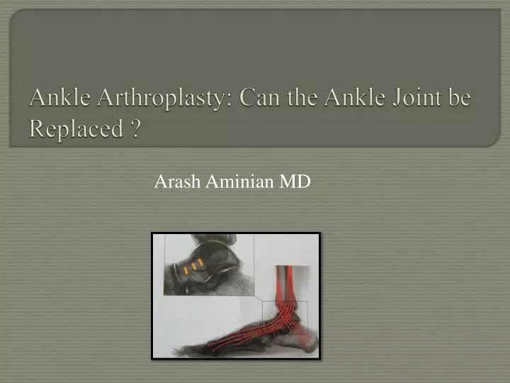 ankle arthroplasty can the ankle joint be replaced