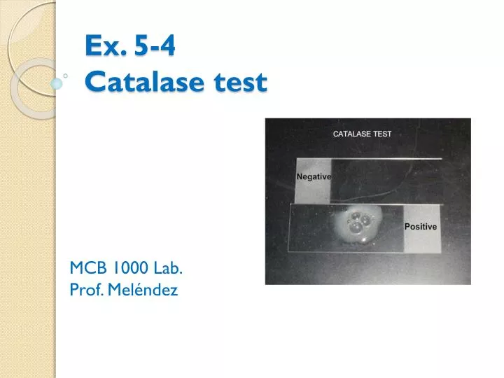 ex 5 4 catalase test