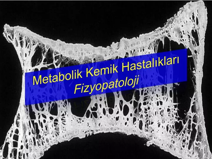metabolik kemik hastal klar fizyopatoloji