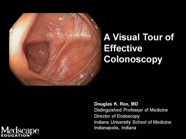 a visual tour of effective colonoscopy