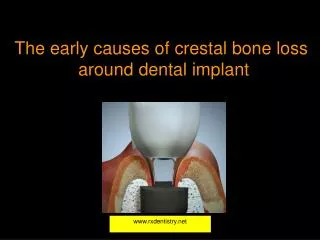 The early causes of crestal bone loss around dental implant