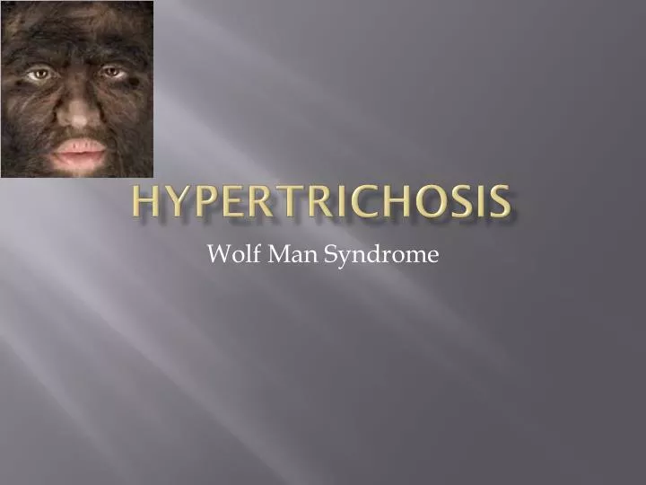 hypertrichosis