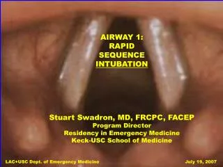 AIRWAY 1: RAPID SEQUENCE INTUBATION Stuart Swadron, MD, FRCPC, FACEP Program Director