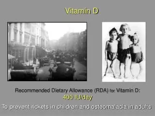 Recommended Dietary Allowance (RDA) for Vitamin D: 400 IU/day