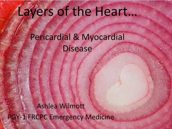 layers of the heart pericardial myocardial disease