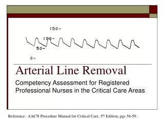 Arterial Line Removal