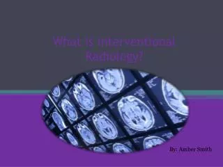 What is interventional Radiology?