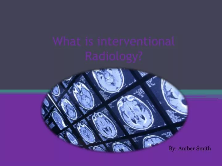 what is interventional radiology