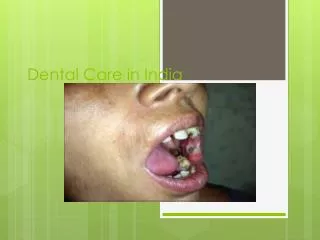 Dental Care in India