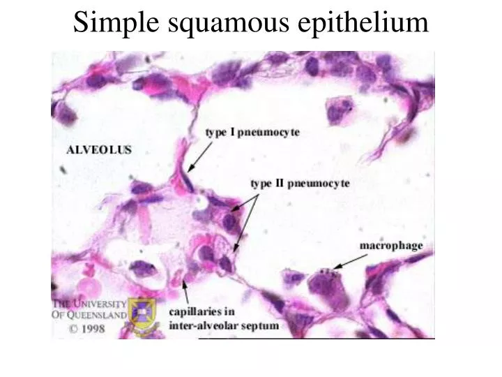 simple squamous epithelium