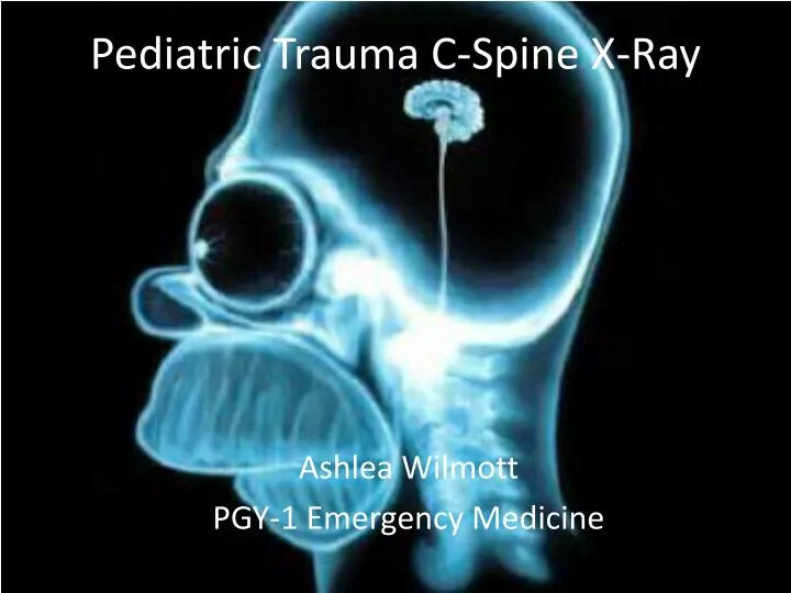 pediatric trauma c spine x ray