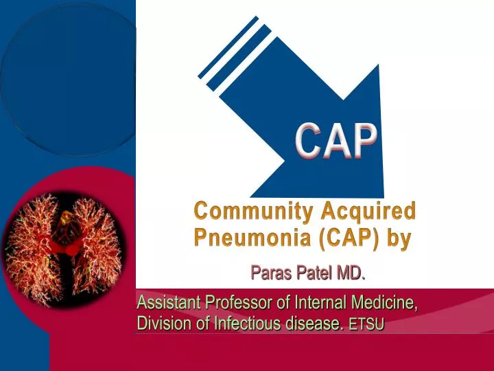 community acquired pneumonia cap by