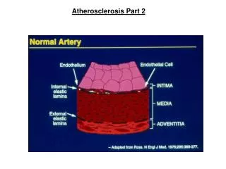 Atherosclerosis Part 2