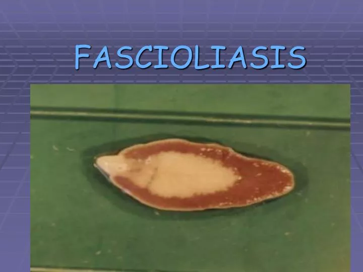 fascioliasis