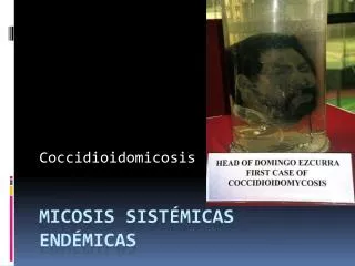 coccidioidomicosis