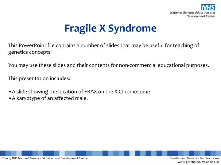 fragile x syndrome