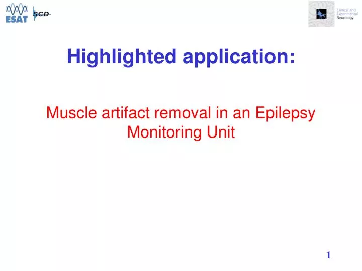 muscle artifact removal in an epilepsy monitoring unit