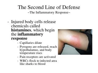The Second Line of Defense ~The Inflammatory Response~