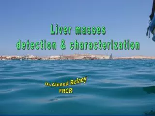 Liver masses detection &amp; characterization