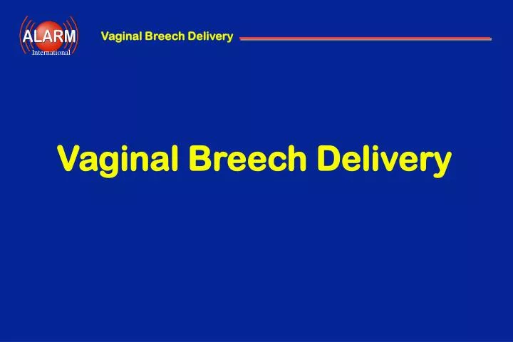 vaginal breech delivery