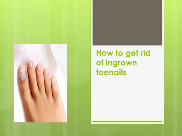 how to get rid of ingrown toenails